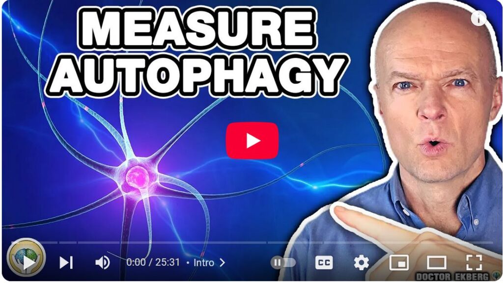 Autophagy and Fasting